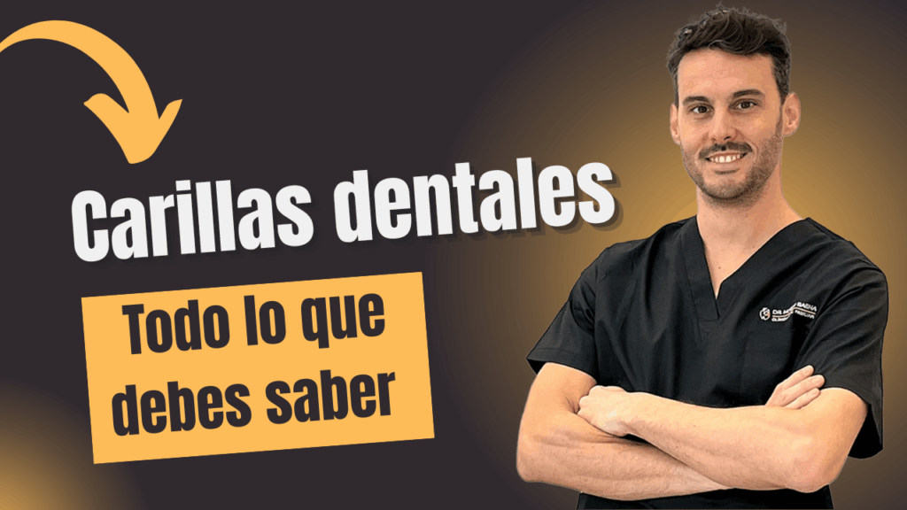 Carillas dentales